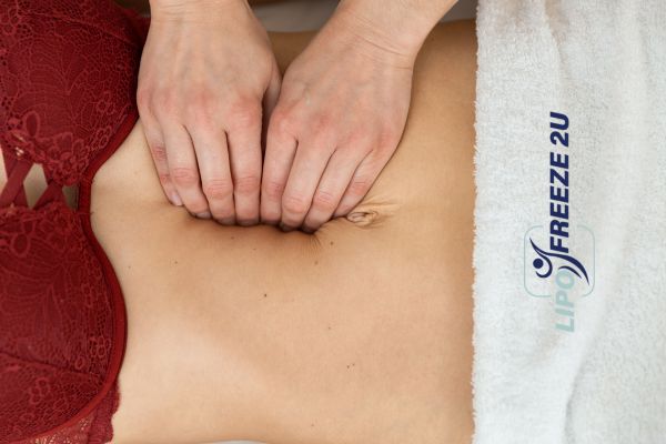 diastasis recti treatment West Bromwich