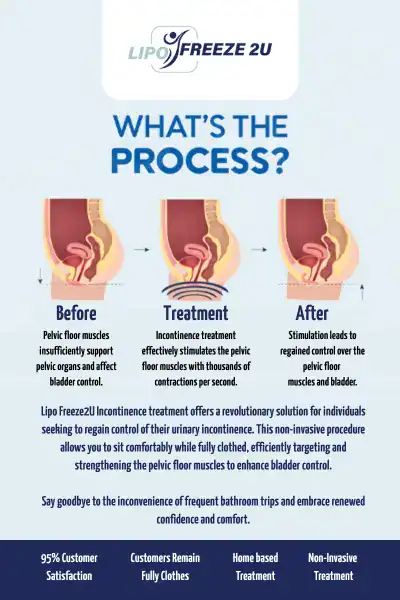 Diagram of how incontinence treatment West Bromwich works.