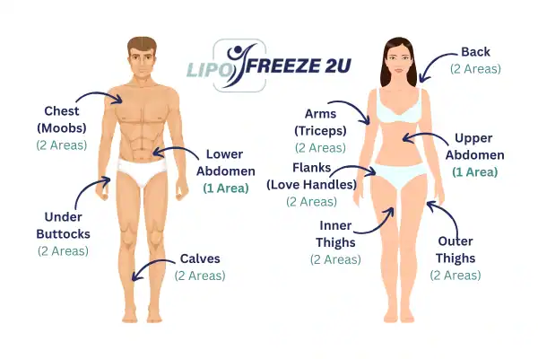 Areas you can have fat freezing treatment West Bromwich