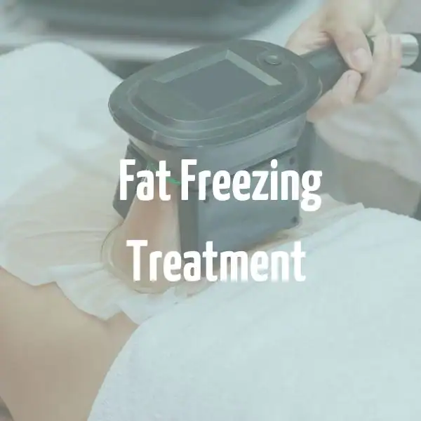 fat freezing treatment West Bromwich