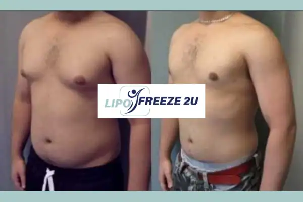 How Long Does It Take to See Results West Bromwich?