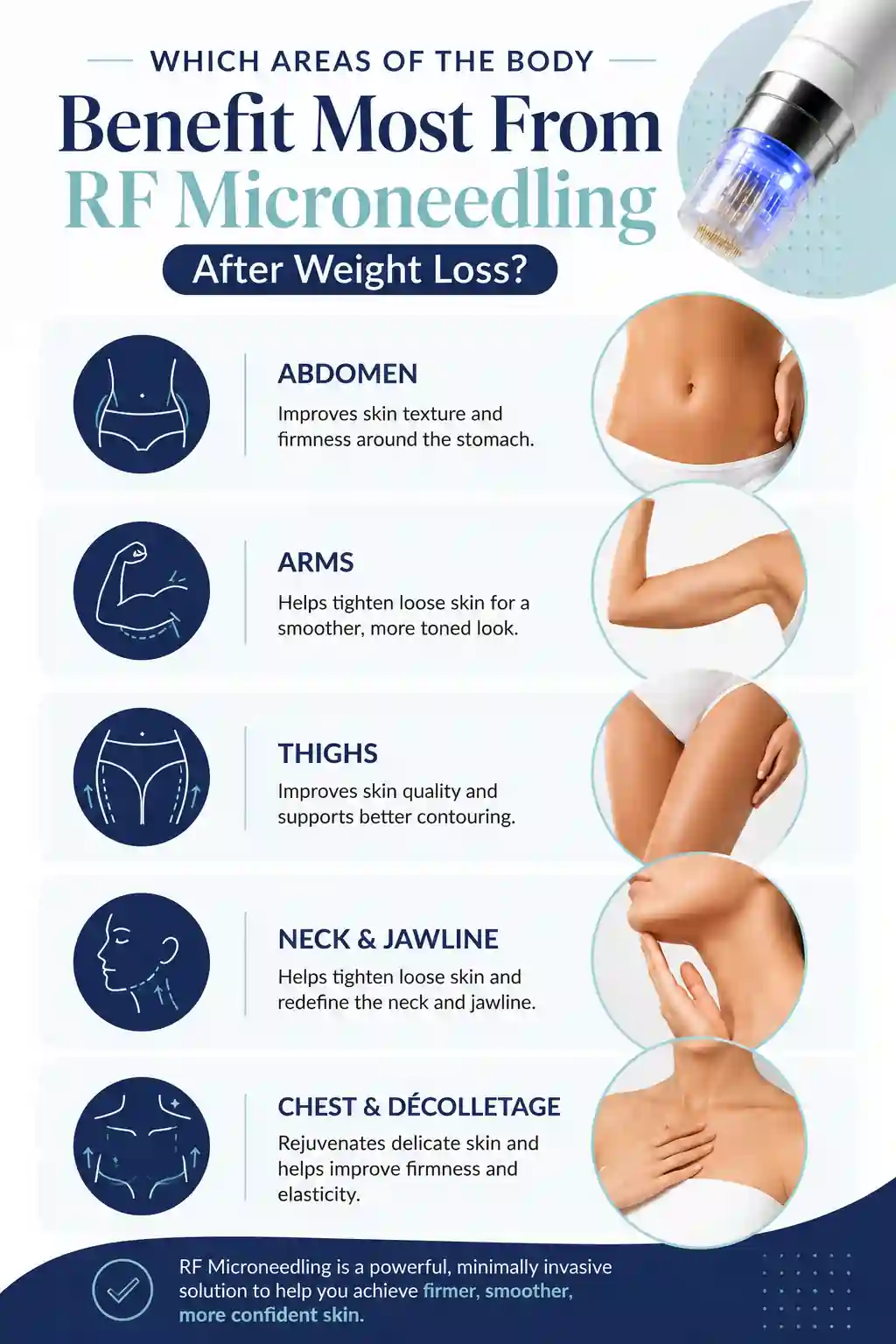Which Areas of the Body Benefit Most From RF Microneedling After Weight Loss West Bromwich